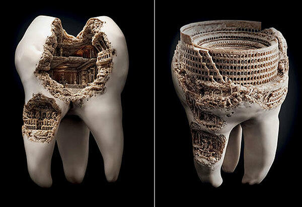 Fransız diş həkimindən diş ağrıları haqqında bilmədiyiniz QƏRİBƏ FAKTLAR