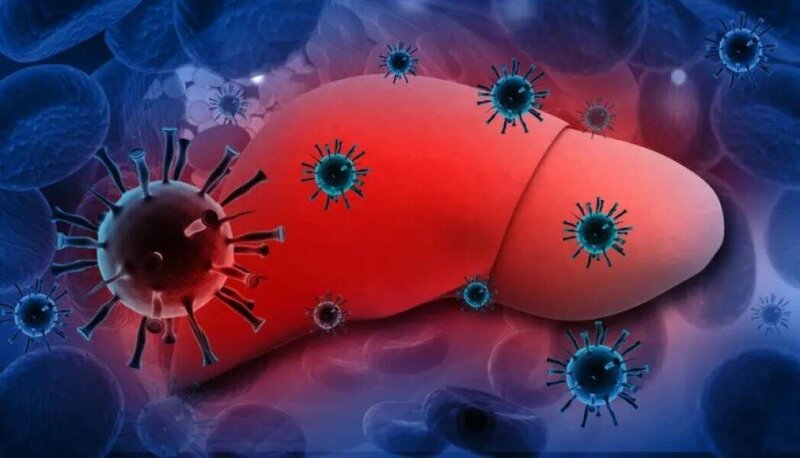 Qorxulu hepatit 33 ölkədə: 9 uşaq öldü, 75%-dən çoxu