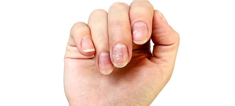 Sink çatışmazlığı nələrə səbəb olur? - problemi aradan qaldırmağın yolları