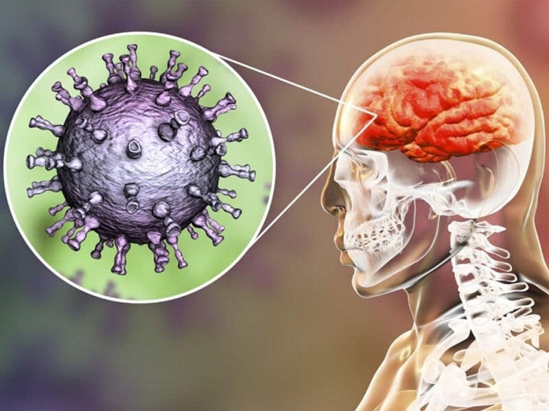 Peyvənd olunmamış meyvələr beyin iltihabına səbəb olur