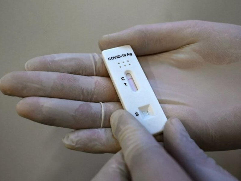 Stels omikron ştamı testsiz necə təyin edilir?