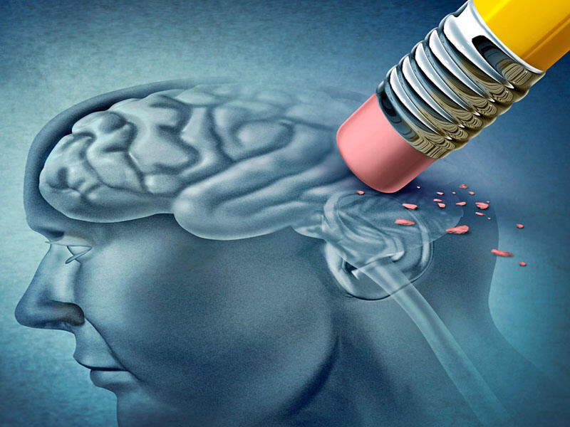 Altsheymer xəstəliyinin 10 risk faktoru