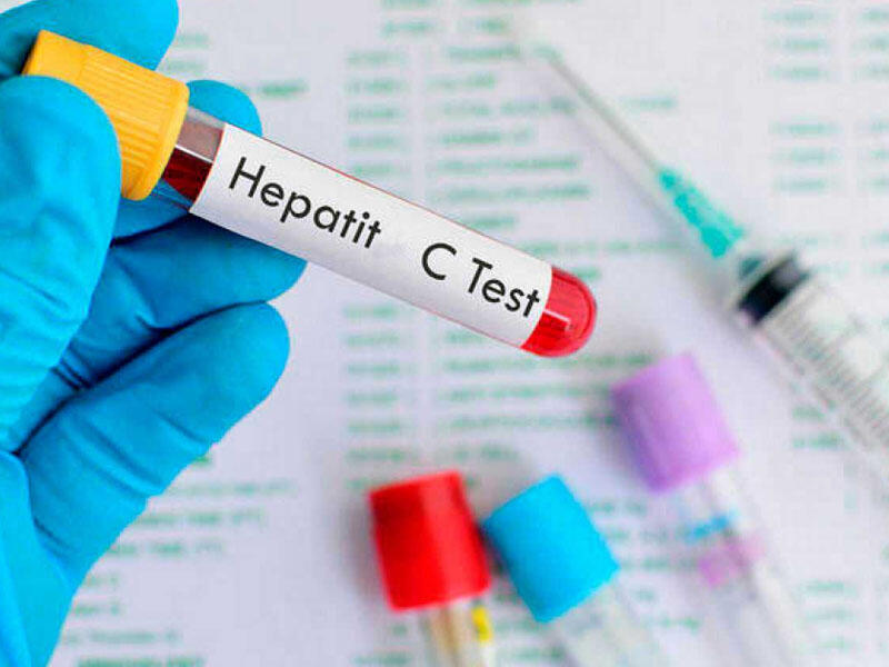 Hepatit C-nin zamanında düzgün müalicəsi