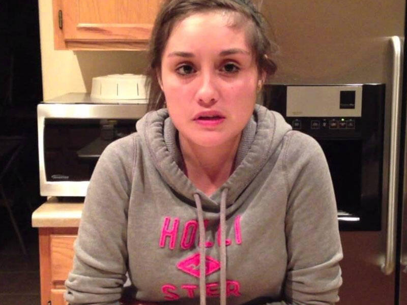 Vilson-Konovalov xəstəliyi