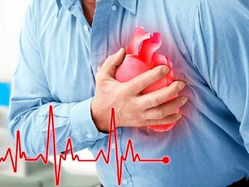 Miokard infarktı-Ürək tutması