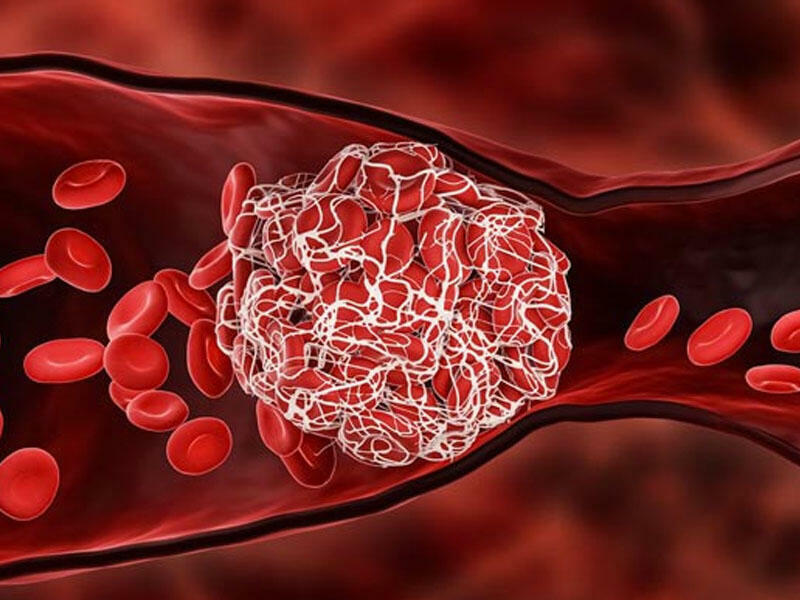 Qanı durulaşdıran və trombların qarşısını alan 3 İÇKİ