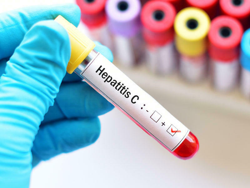 Hepatit C-nin təbii yollarla müalicəsi