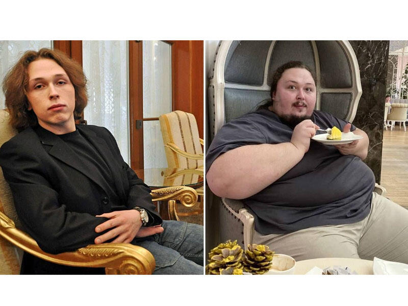 Rusiyalı rəssamın oğlu sanksiyalar səbəbindən 300 kilo oldu