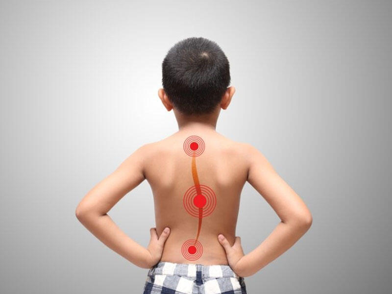 Uşaqlarda skolioz və yastıpəncəlilik - Nazirlik ekspertindən tövsiyə