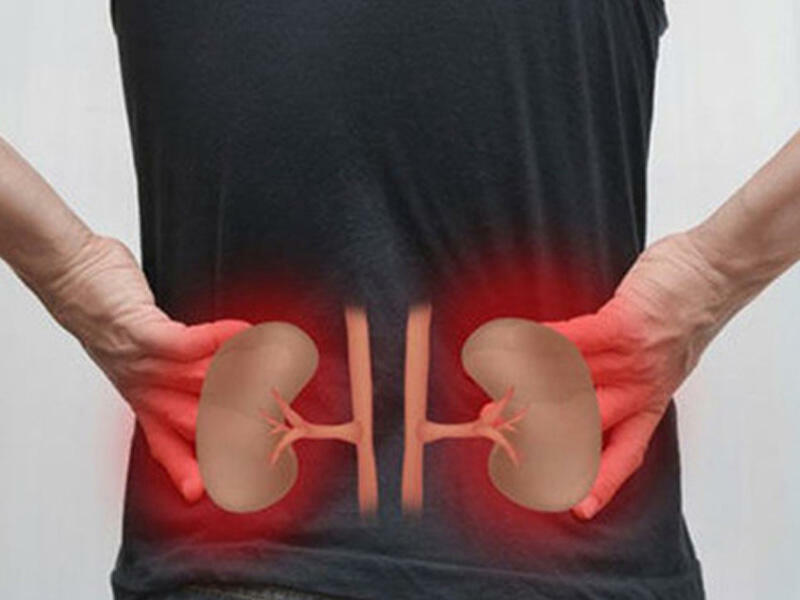 Böyrək və sidik axarlarının təbii vasitələrlə müalicəsi