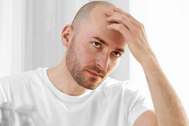 Keçəllik tarixə qovuşur: Artıq laboratoriyada saç yetişdiriləcək