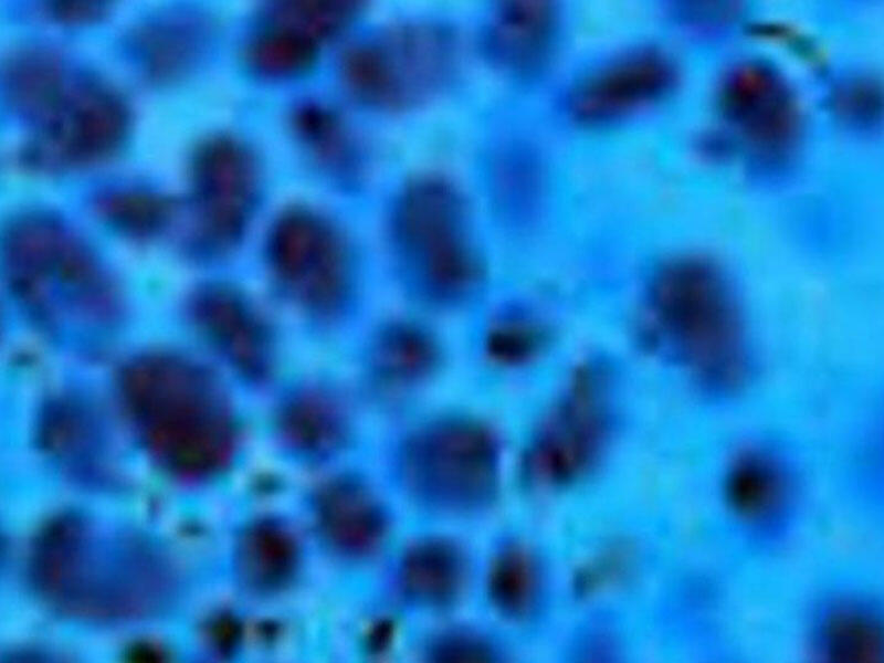 Bədənimizdə yaşayan bakterilər bizi xərçəngdən qoruyur