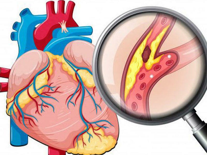 Damarlarımızın əsas düşmənləri. Onlar bizi gizlicə öldürür