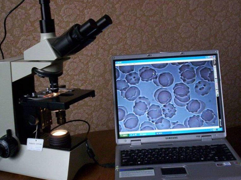 Qanın ən dəqiq analizi - Qaranlıqsahəli mikroskopiya