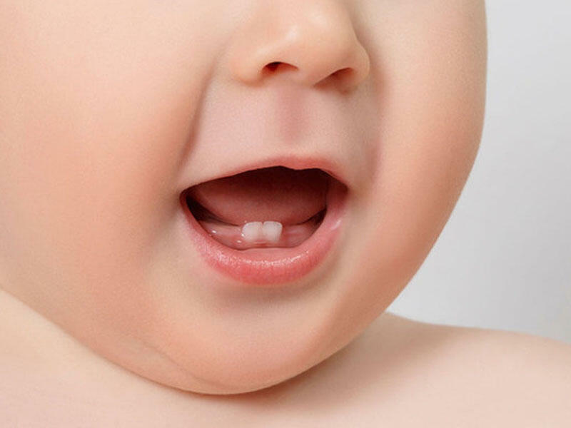 Uşaqlarda diş çıxarmağın əsas əlamətləri