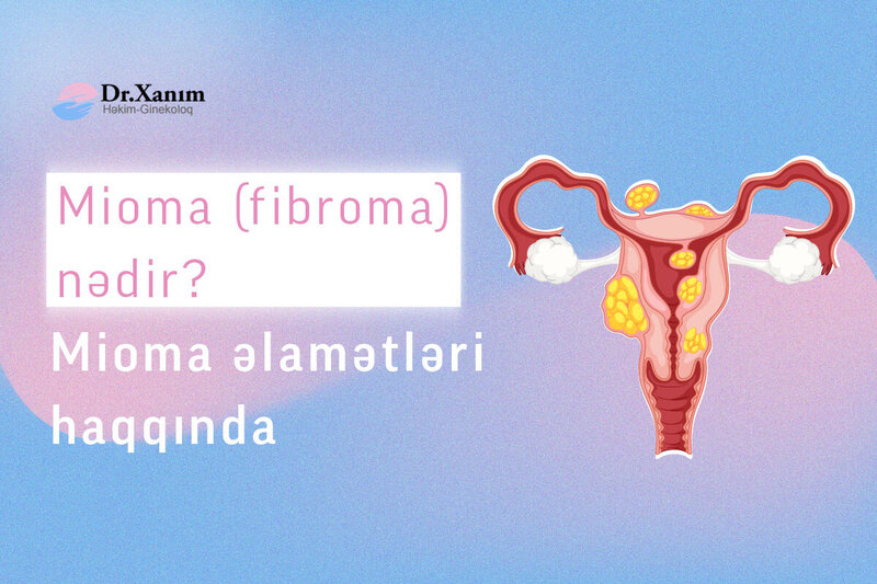 Mioma (Fibroma) və əlamətləri haqqında bilmədikləriniz - Ginekoloq Xanım Adıgözəlova