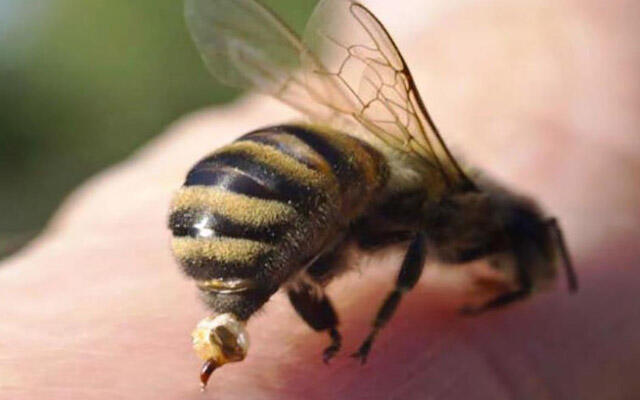 Arı sancması hansı halda ölümə səbəb ola bilər?