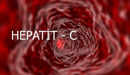 Hepatit C