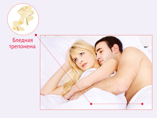 Sifilis nədir?