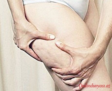 Sellülitin dostu və düşməni olan qidalar