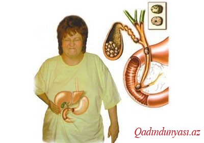 Öd kisəsi