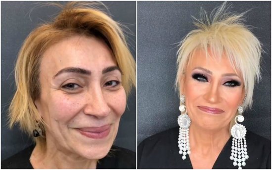 Anar əməkdar artisti tanınmaz hala saldı - VİDEO