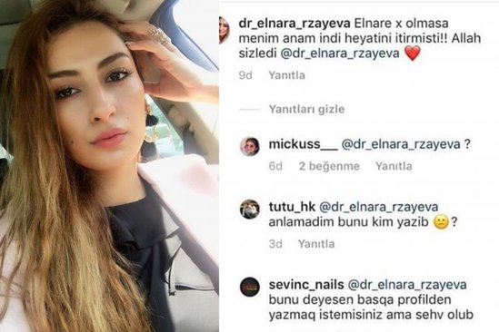 Azərbaycanda kosmetoloq BİABIR OLDU : elə vəziyyətə düşdü ki... - Foto