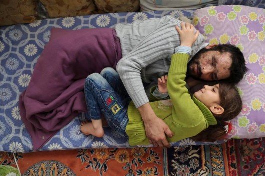 Suriyalı bu qızın FOTOSU ÜRƏKLƏRİ DAĞLADI
