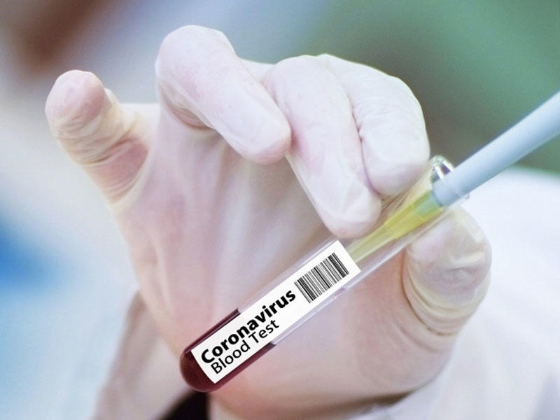 Koronavirusun simptomsuz növü neçə gün çəkir?