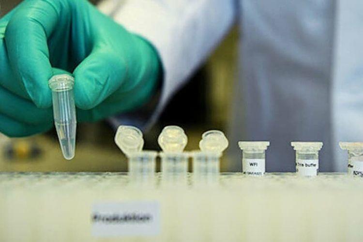 Çində ilk dəfə Böyük Britaniyada yayılan təhlükəli virus tapılıb