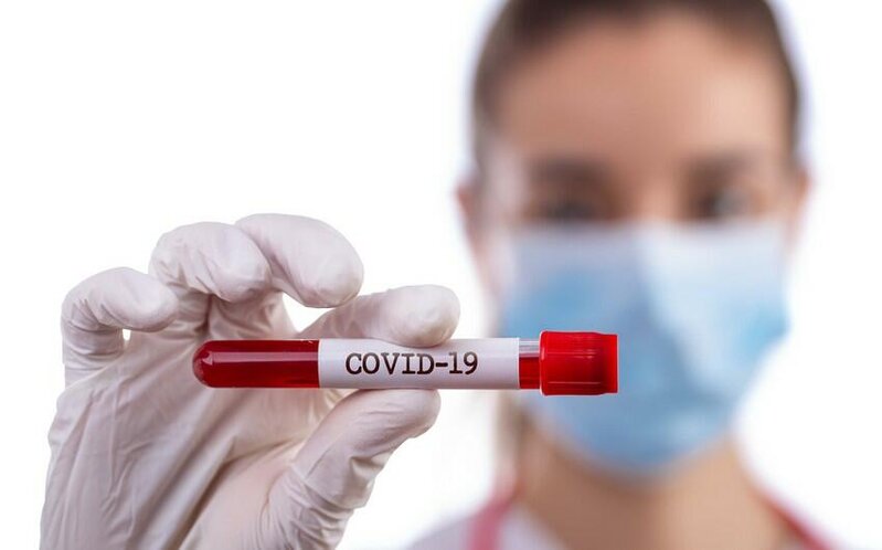 Koronavirusa yoluxub sağaldığınızı testsiz necə bilmək olar?