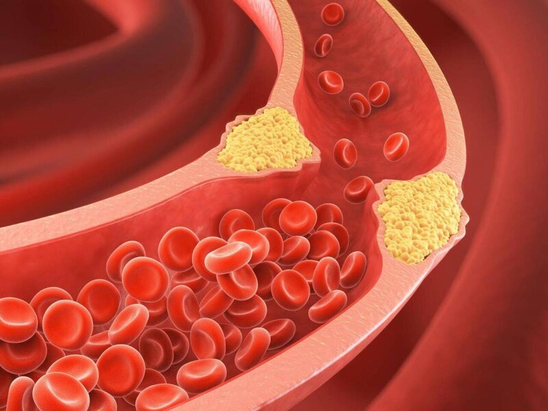 Xolestrini azaldan meyvə - Kilosu 1 manat 50 qəpikdir