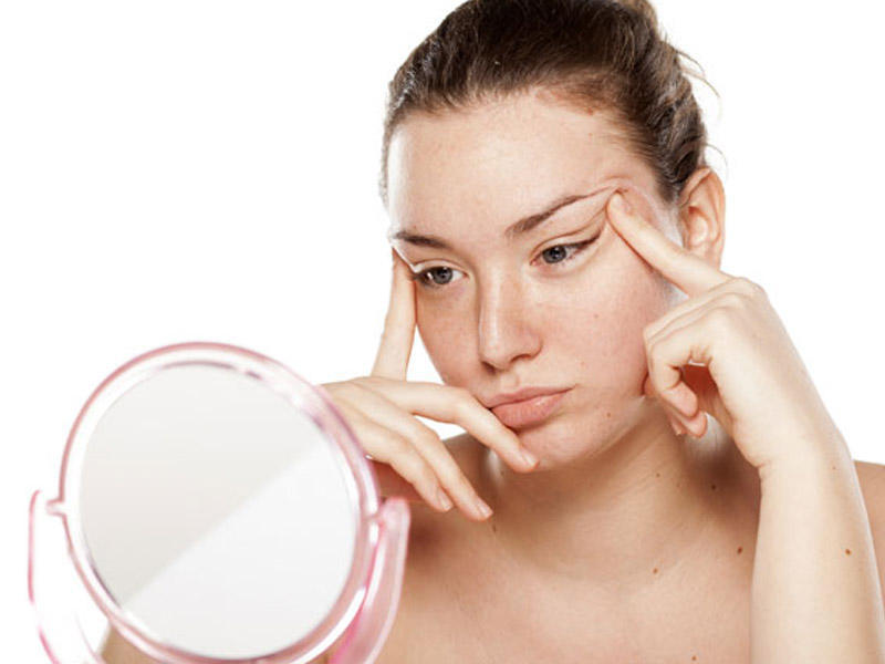 Dəriniz yağlı, normal yoxsa qurudur? SADƏ TESTlə təyin edin