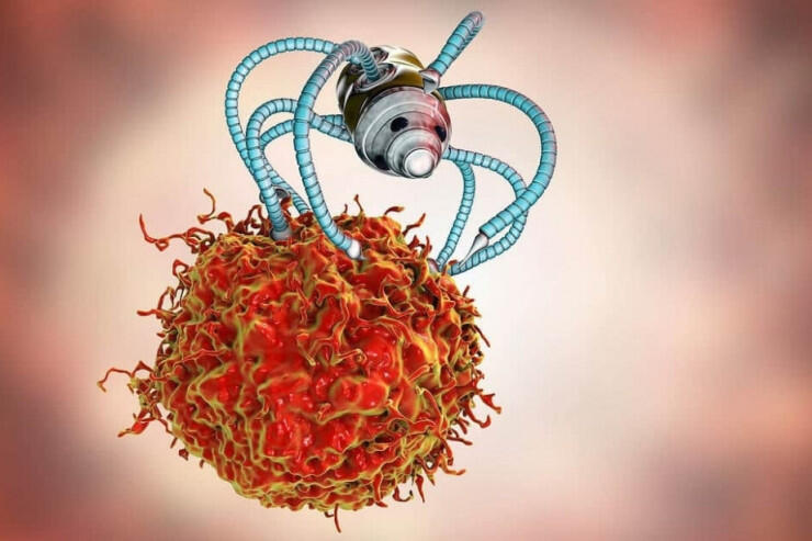 İndi xərçəngi mikrocərrahi robot əməliyyat edəcək