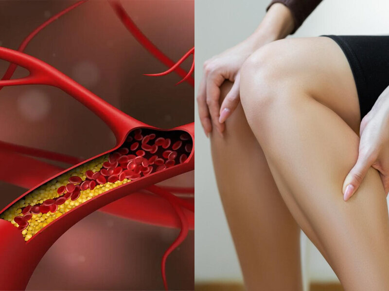 Qan laxtalanması problemi genetik imiş