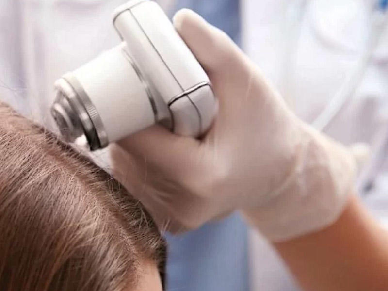 Saçların erkən ağarmasının 12 səbəbi – Bu xəstəliklərdən ola bilir