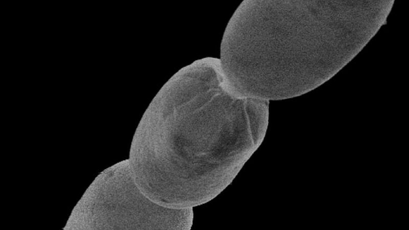 Dünyanın ən böyük bakteriyası aşkar edildi