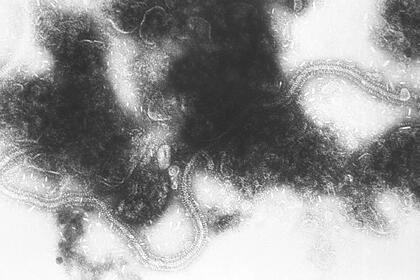 Ölümcül və geniş yayılmış infeksiyanın mexanizmi aşkar edildi