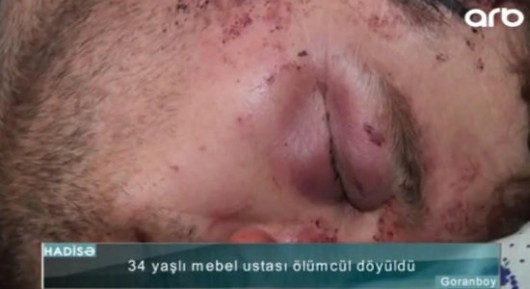 Huşunu itirənə qədər döyülən Goranboy sakininin ŞOK GÖRÜNTÜLƏRİ yayıldı - VİDEO + FOTOLAR
