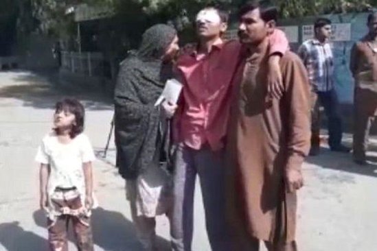 Ata qızı ilə yatan 15 yaşlı oğlanın cinsiyyət orqanını kəsdi, gözlərini çıxartdı - DƏHŞƏTLİ FOTO