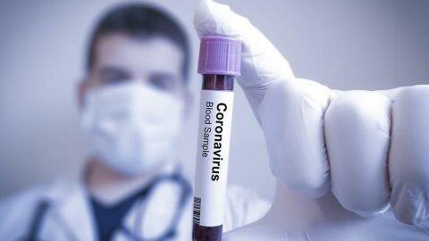 XƏBƏRDARLIQ: koronavirus hər il gələcək