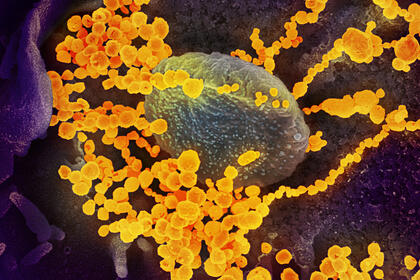 Koronavirusun dəhşətli xüsusiyyəti açıqlandı