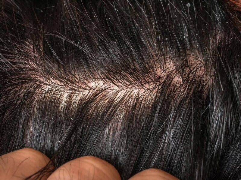 Çox addam ciddiyə almır - Ağır xəstəliklərin əlaməti ola bilər