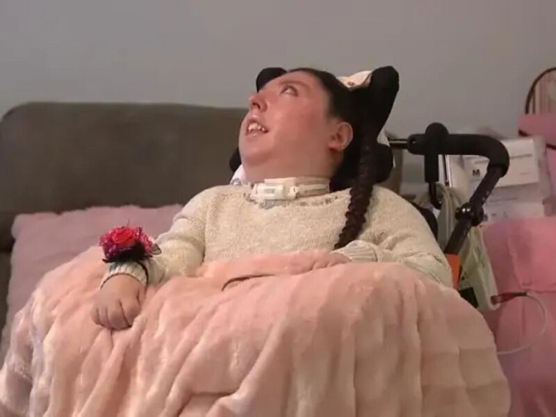 20 il beyinsiz yaşadı