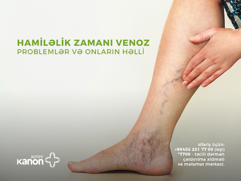 Hamiləlik zamanı venoz problemlər və onların həlli