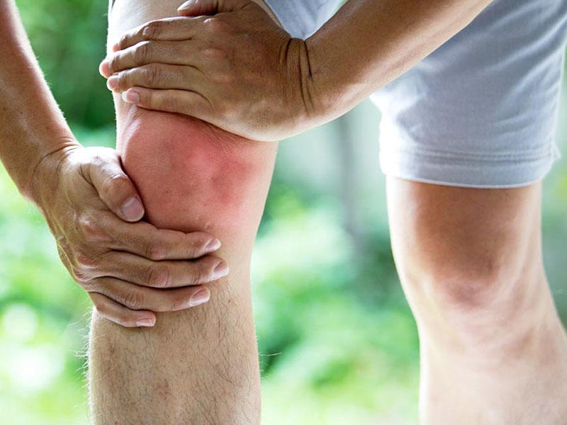 Oynaqlarda "duzlaşma" - artroz nədir?