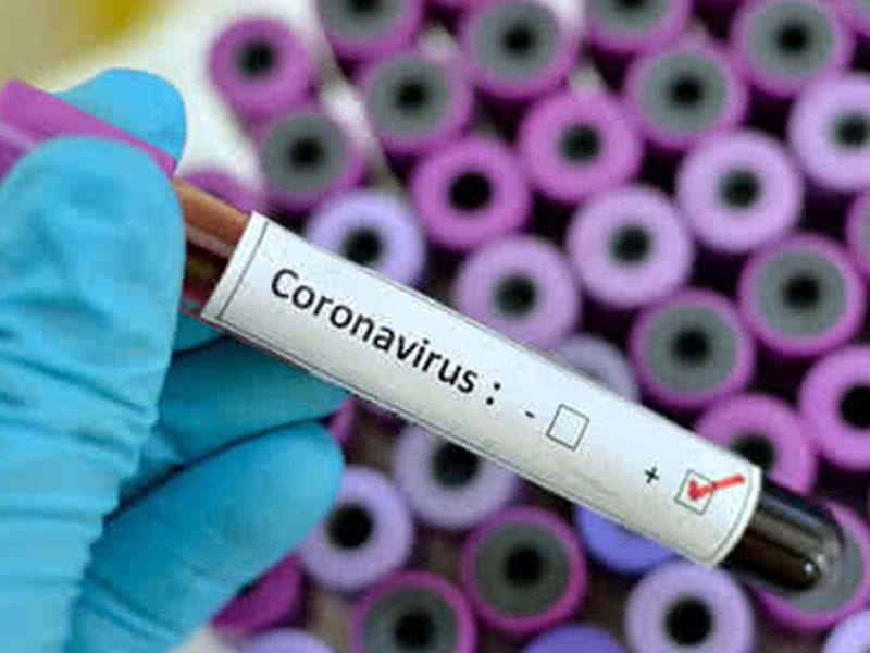 Koronavirusla bağlı əhaliyə tövsiyələr