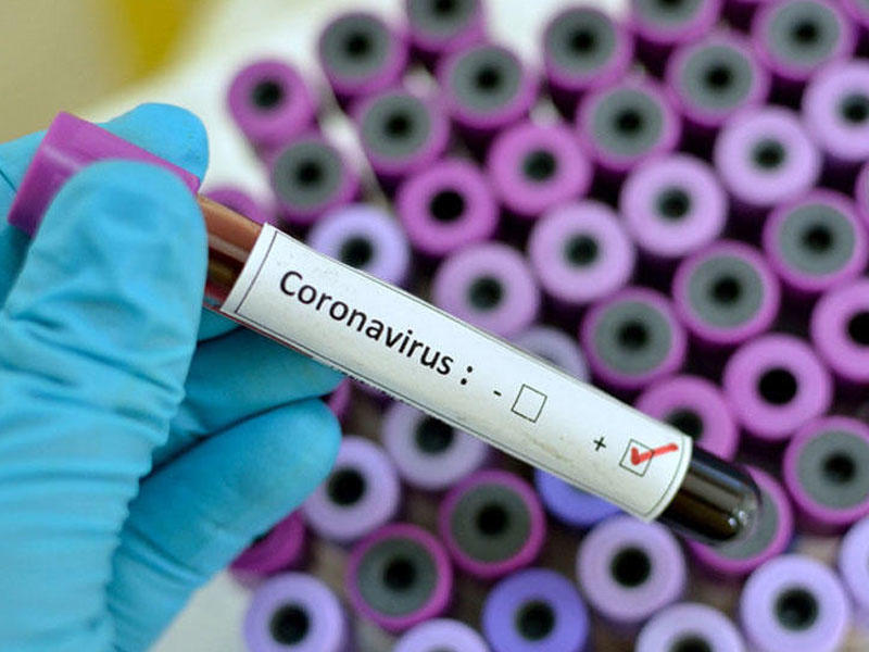 Şri-Lankada ilk koronavirusa yoluxma - Turbələdçi karantinə alındı