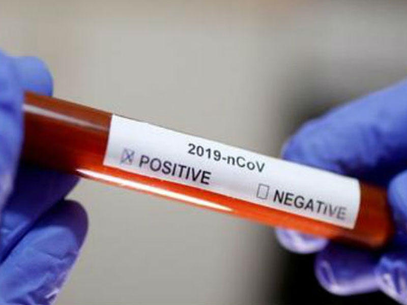 Bu preparat koronavirusun qarşısını ala biləcək - Alimlərin yeni tədqiqatı - FOTO
