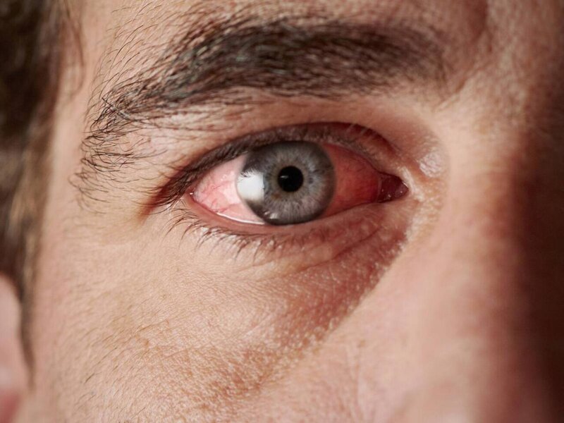 Gərginsinizsə bu vitamininiz çatışmır